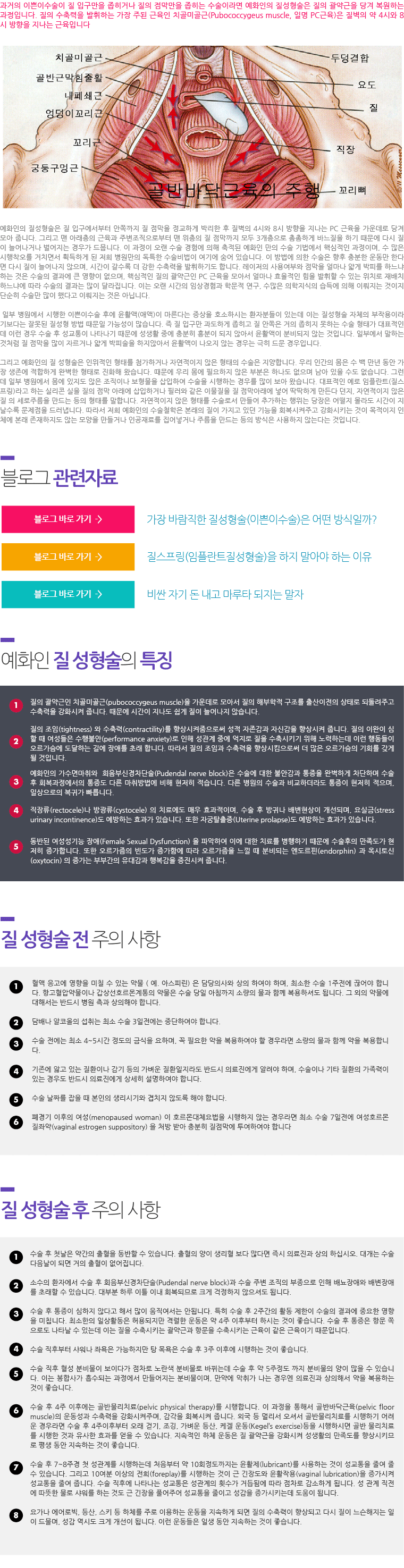 미스질성형술