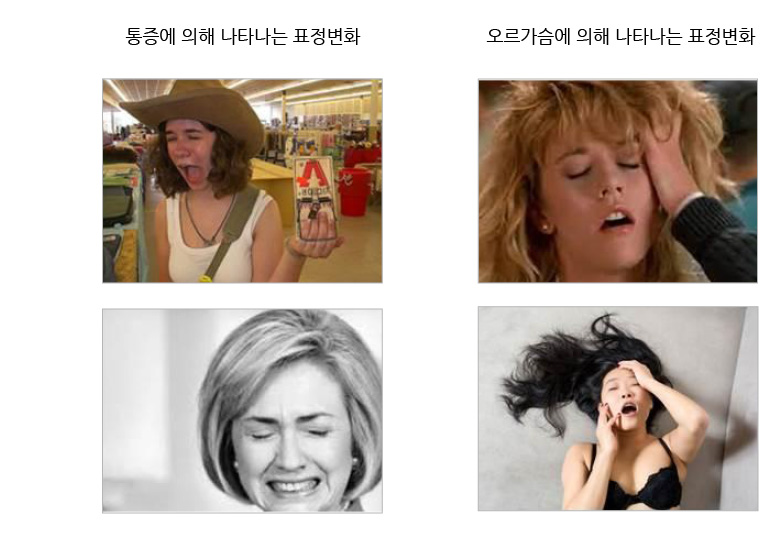 지속성성기흥분장애