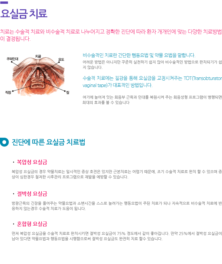 요실금 치료