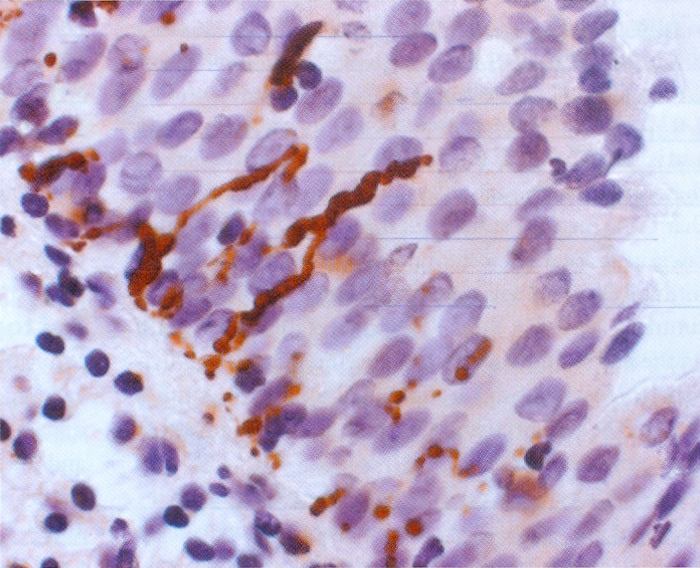 Добро пожаловать в женскую больницу Ехваин